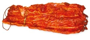 Ребро 2 с. (хребет)